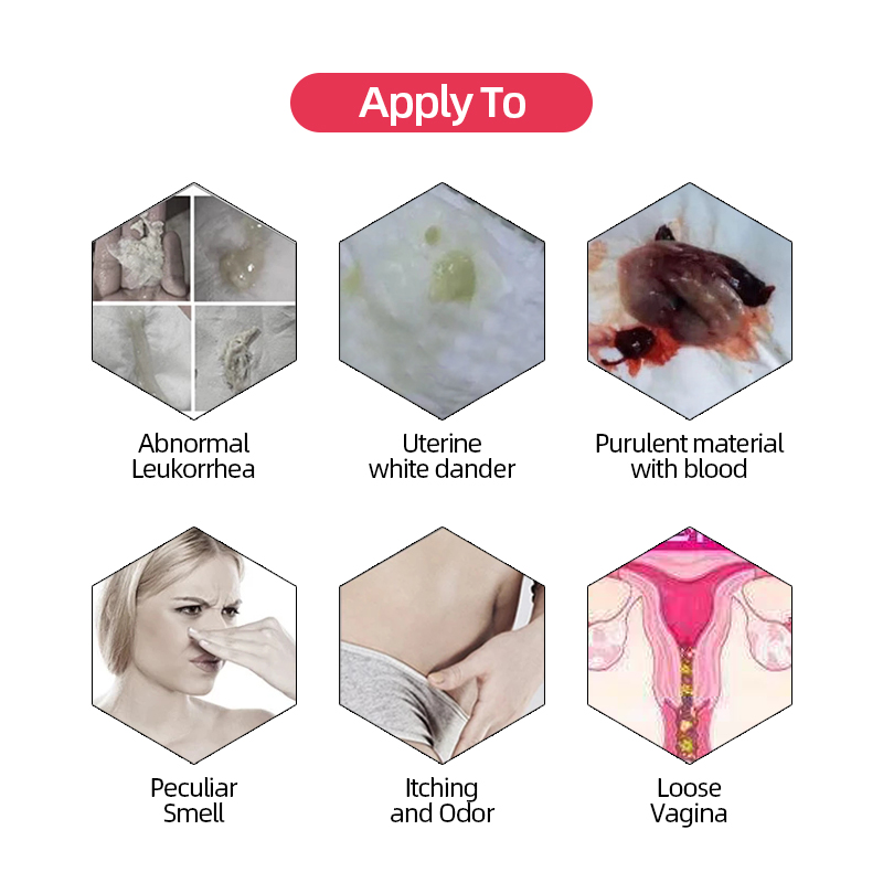 Detox Vaginal Tighten Gynecology Vaginitis Treatment 